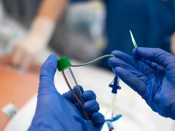 Professional Radiofrequency Ablation Therapy services by Premier Injury Specialists in Riverdale, GA — licensed Injury Specialists provider